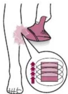 PHILIPS Lumea BRI977 - C Treatment - 3
