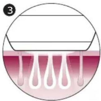 PHILIPS Lumea BRI977 - How IPL works - 3