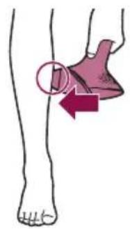 PHILIPS Lumea BRI977 - B Test skin 24 hrs before treatment - 5