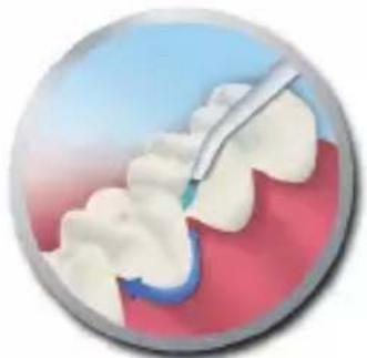GRUNDIG TBB 80 - Interdental brush - 1