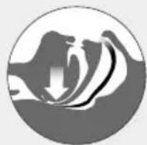 ResMed Narval CC - Indikationen - 5