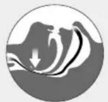 ResMed Narval CC - Behandeling follow-up - 1