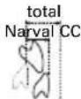 ResMed Narval CC - Symboler - 12