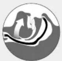 ResMed Narval CC - Behandeling follow-up - 3