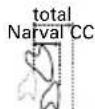 ResMed Narval CC - REF - 5