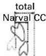 ResMed Narval CC - Symbolen - 12
