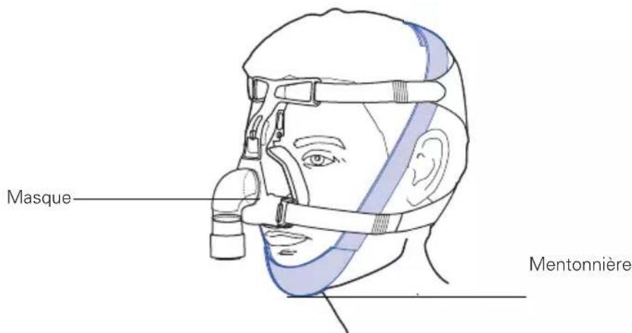 ResMed Chin Restraint - 1
