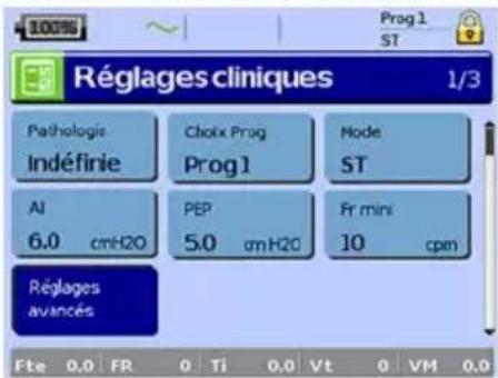 ResMed Stellar 150 - Menu Réglages : Réglages cliniques (Type de masque) - 1
