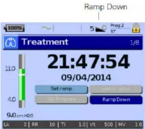 ResMed Stellar 150 - Ramp Down - 1