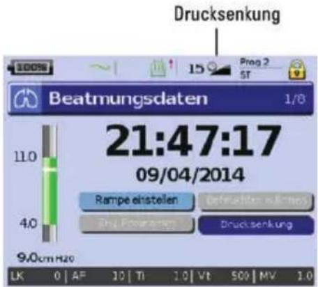 ResMed Stellar 150 - Drucksenkung - 1
