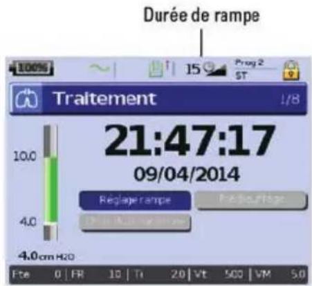 ResMed Stellar 150 - Réglage de la rampe - 1