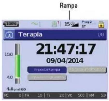 ResMed Stellar 150 - Personalizzazione delle opzioni di impostazione della terapia - 1