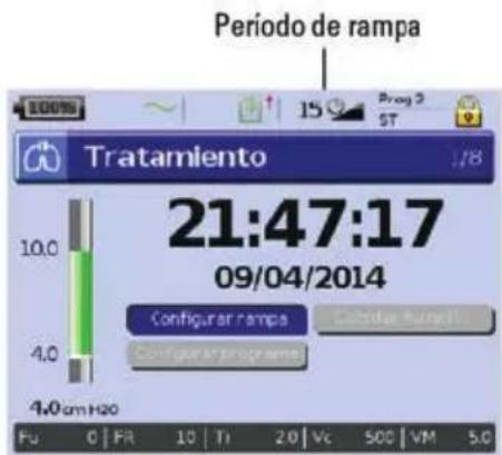ResMed Stellar 150 - Adaptación de las opciones de configuración del tratamiento - 1