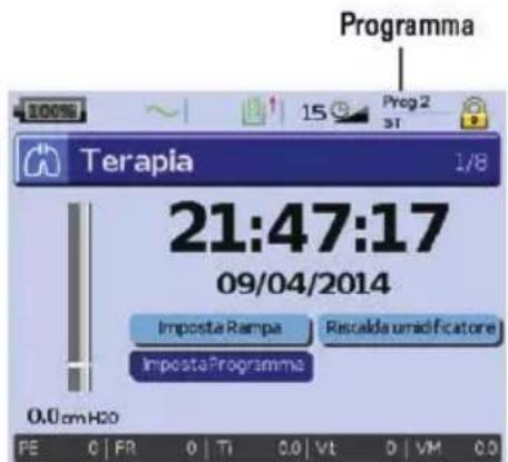 ResMed Stellar 150 - Personalizzazione delle opzioni di impostazione della terapia - 2