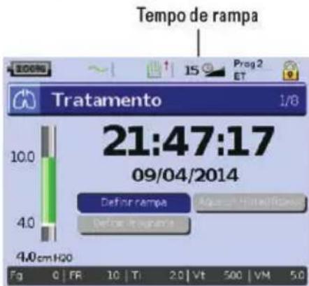 ResMed Stellar 150 - Personalização das opções de configuração de tratamento - 1