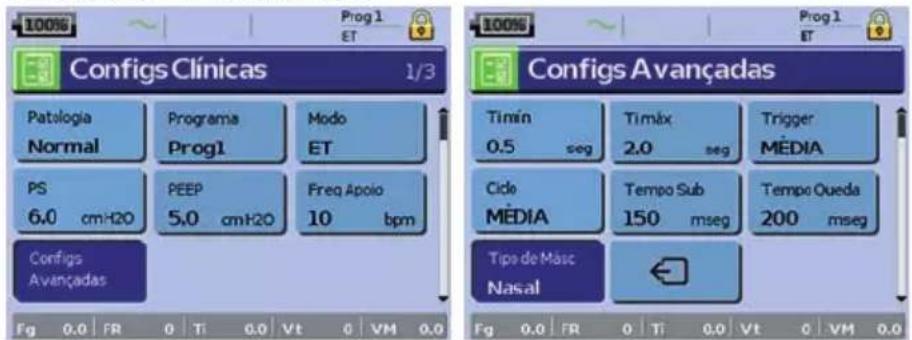 ResMed Stellar 150 - Menu Configuração: Configurações Clínicas (Tipo de Máscara) - 1