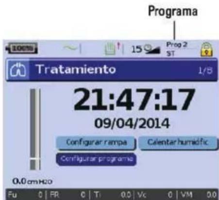 ResMed Stellar 150 - Adaptación de las opciones de configuración del tratamiento - 2