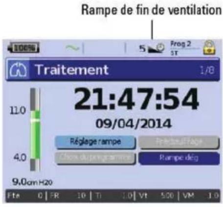 ResMed Stellar 150 - Rampe de fin de ventilation - 1