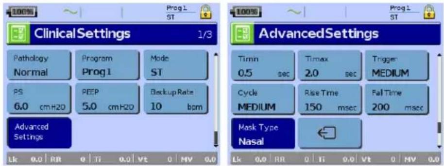 ResMed Stellar 150 - Setup menu: Clinical Settings (Mask Type) - 1