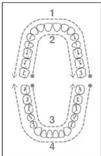 NEVADENT SMD 24 A1 - OPMERKING - 2