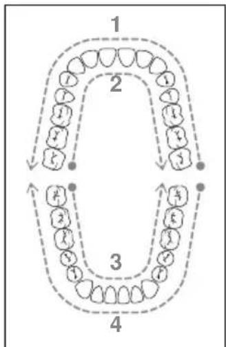 NEVADENT SMD 24 A1 - REMARQUE - 2