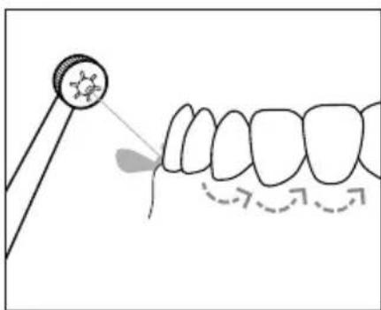 NEVADENT SMD 24 A1 - W step 104 - 3