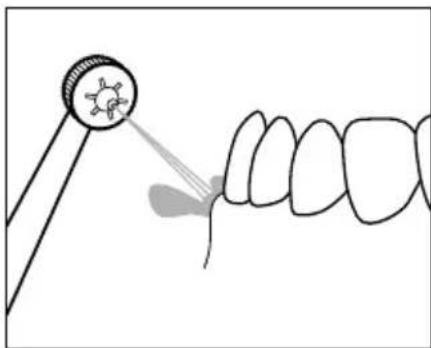 NEVADENT SMD 24 A1 - Adjusting the nozzle control - 4
