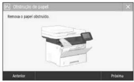 CANON i-SENSYS MF542x - Ocorreram obstruções de papel - 1