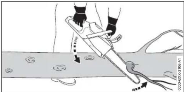 Medical illustration showing a surgical procedure on a tool, with arrows indicating movement and measurement points.