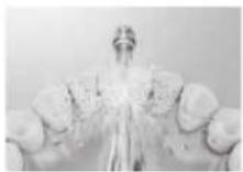 PANASONIC EW-DJ86 - Tannkjøttpleie - 1