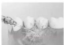 PANASONIC EW-DJ86 - Îngrijirea gingiilor - 1