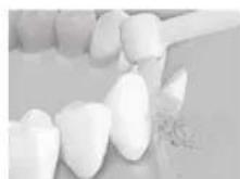 PANASONIC EW-DJ86 - Colocar ligeramente la punta del cepillo sobre los dientes torcidos. - 1