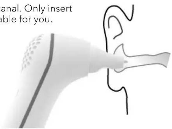 Earbreeze EBD.201 - Risk of Damage! - 2