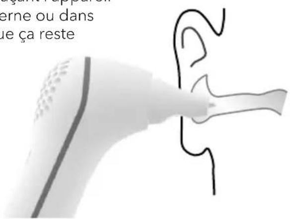 Earbreeze EBD.201 - Risque de dommage ! - 2