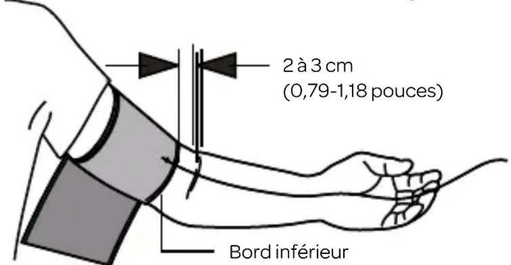 INVENTUM BDA435 - Application du brassard - 2