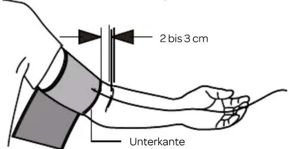 INVENTUM BDA435 - Anlegen der Manschette - 2
