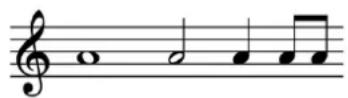 STEINBERG Dorico Elements 3.5 - Apparence de l'ensemble de têtes de notes - 1