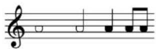 STEINBERG Dorico Elements 3.5 - Apparence de l'ensemble de têtes de notes Nom de l'ensemble de têtes de notes - 1