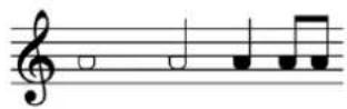 STEINBERG Dorico SE 3 - Apparence de l'ensemble de têtes de notes Nom de l'ensemble de têtes de notes - 1