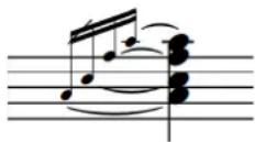 STEINBERG Dorico SE 3 - Liaisons de prolongation entre des notes non adjacentes - 3