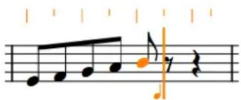 STEINBERG Dorico Elements 4 - Grille rythmique - 1