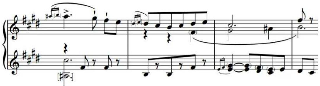 STEINBERG Dorico SE 3.5 - Têtes de notes entre parenthèses ou entre crochets - 1