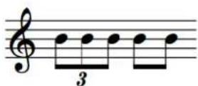 STEINBERG Dorico SE 3.5 - N-olets au sein des ligatures - 2