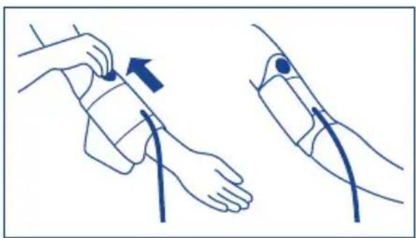 Hartmann Tensoval duo control Large - Applying the cuff - 3