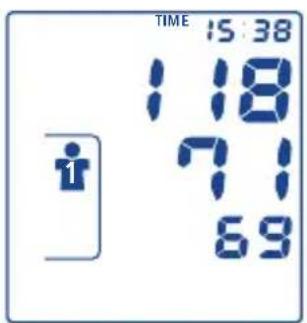 TIME 15:38 118 71 69