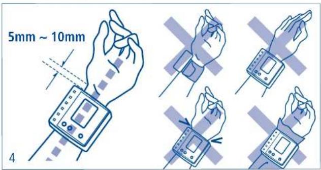 Hartmann Tensoval mobil classic - Mise en place du bracelet - 1