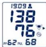 UEBE Visomat comfort 20/40 - Irregular pulses and cardiac arrhythmia - 1