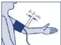 UEBE Visomat comfort 20/40 - Posizionamento del bracciale - 2