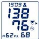 UEBE Visomat comfort 20/40 - Frequenza del polso irregolare e disturbi del ritmo cardiaco - 1