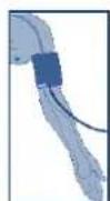 UEBE Visomat double comfort - Attaching the cuff - 3
